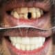 Slider image (9) A-Dent Dental Clinic in Antalya, Turkey